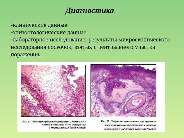 Диагностика -клинические данные -эпизоотологические данные -лабораторное исследование: результаты микроскопического исследования соскобов, взятых с центрального участка поражения. 