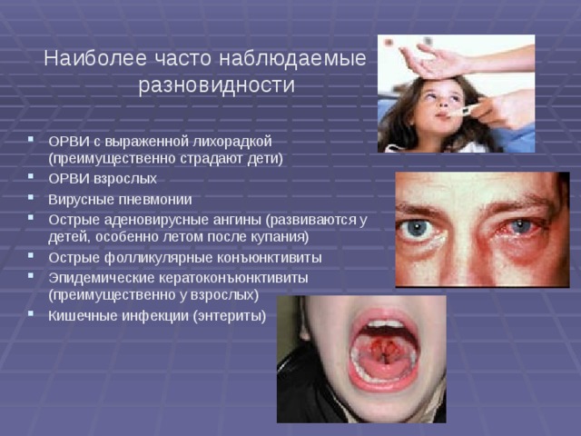 Наиболее часто наблюдаемые разновидности ОРВИ с выраженной лихорадкой (преимущественно страдают дети) ОРВИ взрослых Вирусные пневмонии Острые аденовирусные ангины (развиваются у детей, особенно летом после купания) Острые фолликулярные конъюнктивиты Эпидемические кератоконъюнктивиты (преимущественно у взрослых) Кишечные инфекции (энтериты) 