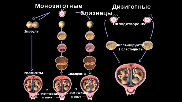 Как появляются близнецы