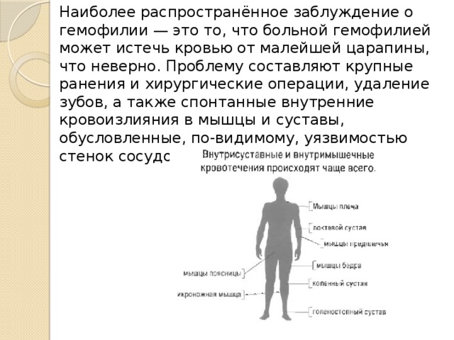 Наиболее распространённое заблуждение о гемофилии — это то, что больной гемофилией может истечь кровью от малейшей царапины, что неверно. Проблему составляют крупные ранения и хирургические операции, удаление зубов, а также спонтанные внутренние кровоизлияния в мышцы и суставы, обусловленные, по-видимому, уязвимостью стенок сосудов у больных гемофилией. 