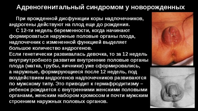 Адреногенитальный синдромом у новорожденных  При врожденной дисфункции коры надпочечников, андрогены действуют на плод еще до рождения.  С 12-ти недель беременности, когда начинают формироваться наружные половые органы плода, надпочечник с измененной функцией выделяет большое количество андрогенов. Если генетически развивалась девочка, то за 12 недель внутриутробного развития внутренние половые органы плода (матка, трубы, яичники) уже сформировались, а наружные, формирующиеся после 12 недель, под воздействием андрогенов надпочечников развиваются по мужскому типу. Это приводит к гермафродитизму – ребенок рождается с внутренними женскими половыми органами, женским набором хромосом и почти мужским строением наружных половых органов. 