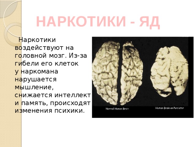 мозг человека после наркотиков
