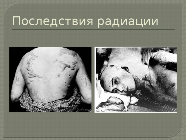 Последствия радиации 