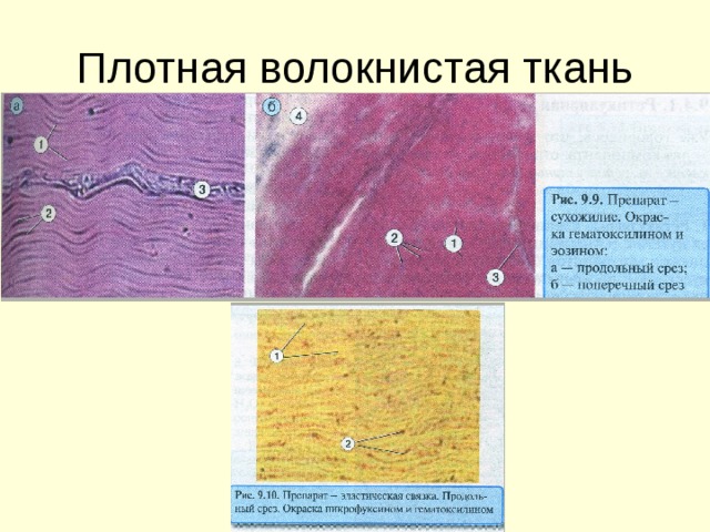 Плотная волокнистая ткань