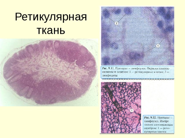 Ретикулярная ткань фото