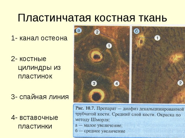 Презентация костная ткань гистология