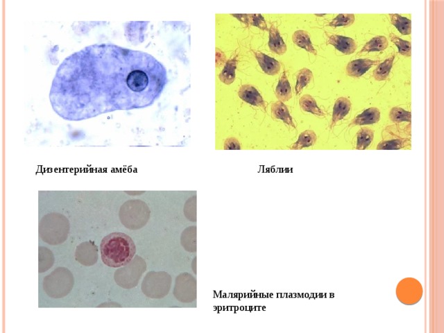 Дизентерийная амёба Ляблии Малярийные плазмодии в эритроците 