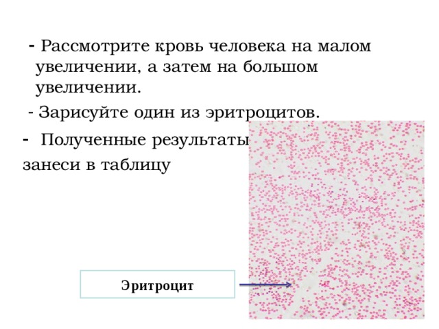  Рассмотрите кровь человека на малом увеличении, а затем на большом увеличении.  - Зарисуйте один из эритроцитов.  Полученные результаты занеси в таблицу Эритроцит 