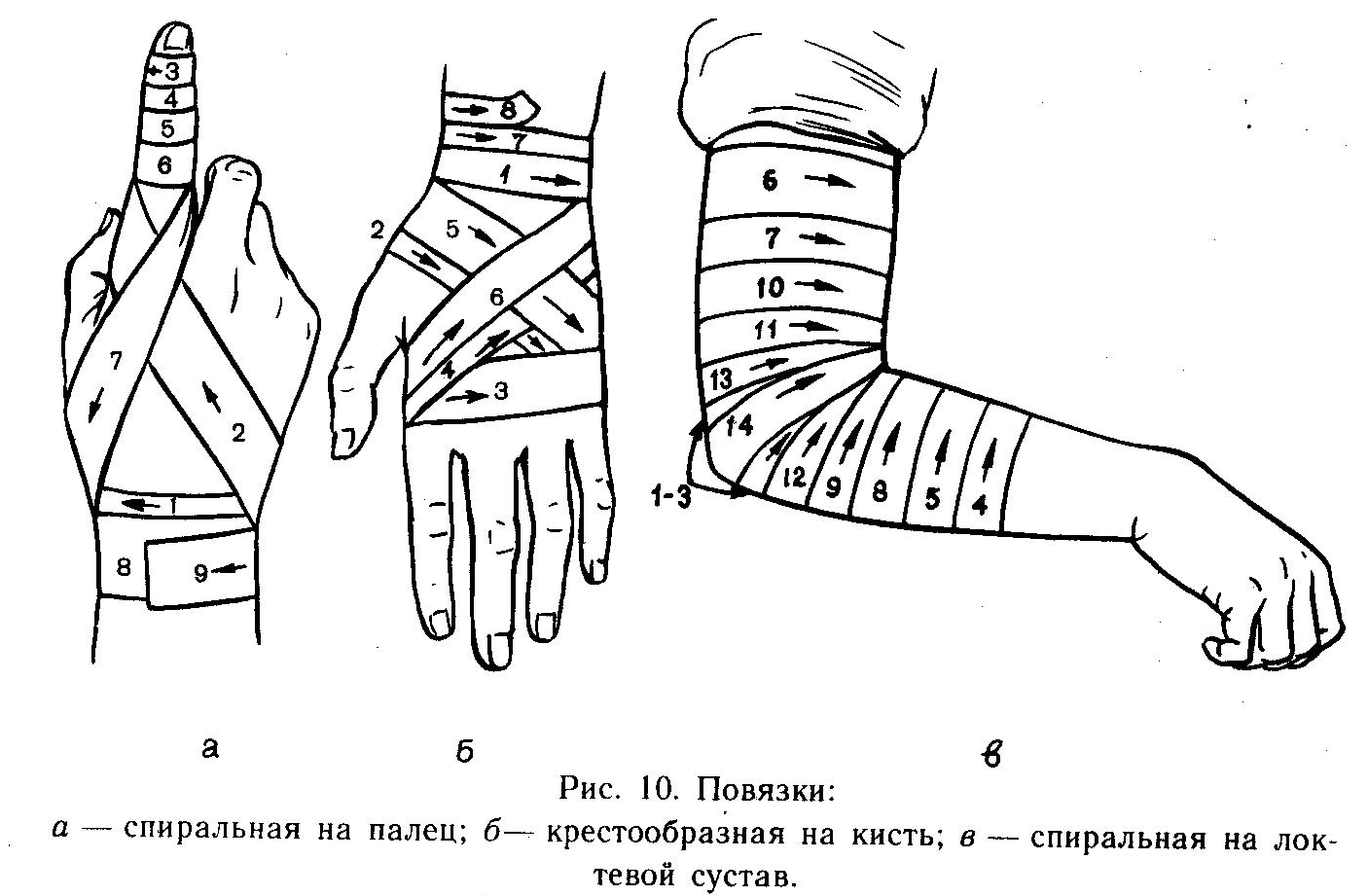 Техника бинтования. Бинтование лучезапястного сустава эластичным бинтом. Бинтовые повязки на конечности. Перевязка на конечности руки. Перевязка локтя эластичным бинтом.