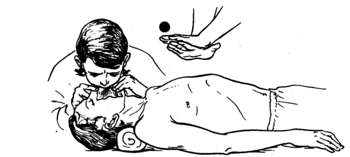 Искусственная реанимация легких и непрямой массаж