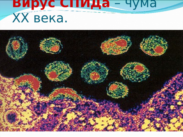 Вирус СПИДа – чума XX века. 