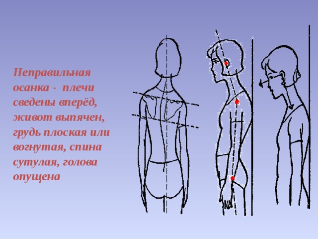 Плечи низко опущены. Плечи сведены вперед. Осанка плечи вперед. Неправильная осанка плечи вперед. Неправильная осанка живот вперед.