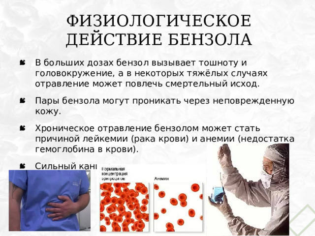 Физиологическое действие бензола В больших дозах бензол вызывает тошноту и головокружение, а в некоторых тяжёлых случаях отравление может повлечь смертельный исход. Пары бензола могут проникать через неповрежденную кожу. Хроническое отравление бензолом может стать причиной лейкемии (рака крови) и анемии (недостатка гемоглобина в крови). Сильный канцероген 