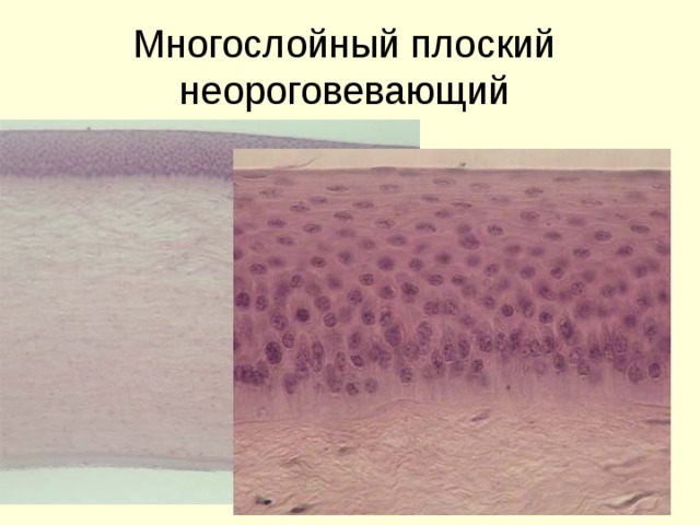 Многослойный плоский  неороговевающий 