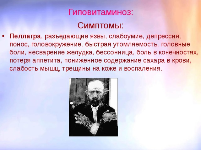 Пеллагра симптомы фото Методические рекомендации к проведению урока биологии по теме: "Витамины" для уч