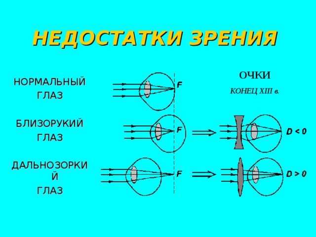 Дополните предложения изображение в близоруком