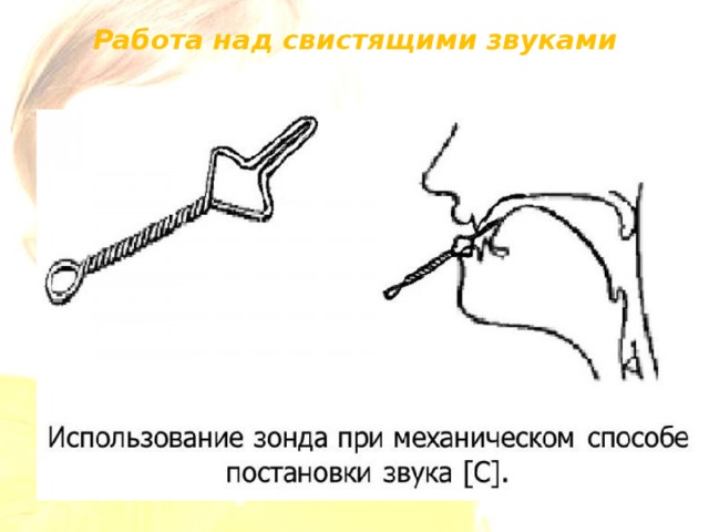 Механическая постановка звуков. Зонды для постановки свистящих звуков. Постановка свистящих звуков с помощью зонда. Логопедические зонды для свистящих звуков. Постановка звука с.