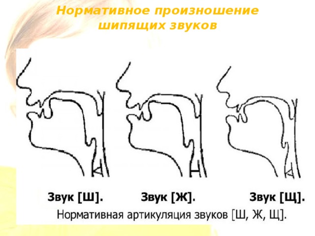 Звук стоять. Схема постановки звуков. Опорный звук для постановки ж. Этапы постановки звука в схемах. Профили артикуляции свистящих звуков при дислалии.