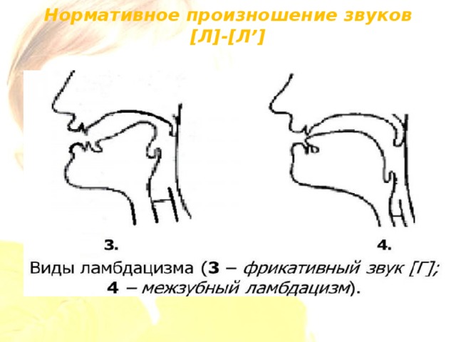 План логопедической работы по преодолению нарушения звукопроизношения межзубный сигматизм