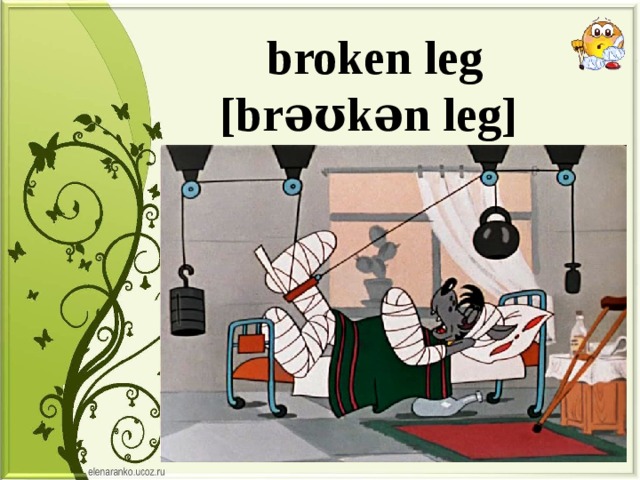 broken leg [brəʊkən leg] 