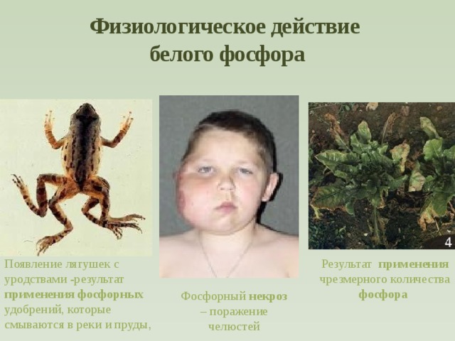 Физиологическое действие  белого фосфора Результат применения чрезмерного количества фосфора  Появление лягушек с уродствами -результат применения  фосфорных удобрений, которые смываются в реки и пруды , Фосфорный некроз – поражение челюстей  