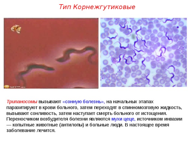 Тип Корнежгутиковые Трипаносомы вызывают «сонную болезнь», на начальных этапах паразитируют в крови больного, затем переходят в спинномозговую жидкость, вызывают сонливость, затем наступает смерть больного от истощения. Переносчиком возбудителя болезни являются мухи цеце, источником инвазии — копытные животные (антилопы) и больные люди. В настоящее время заболевание лечится.  