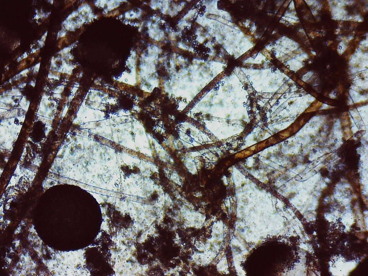 Плесень под микроскопом фото на хлебе