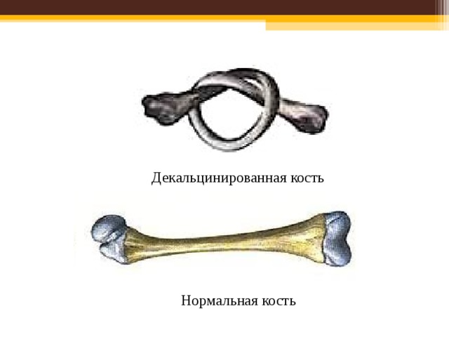 Декальцинированная кость Нормальная кость