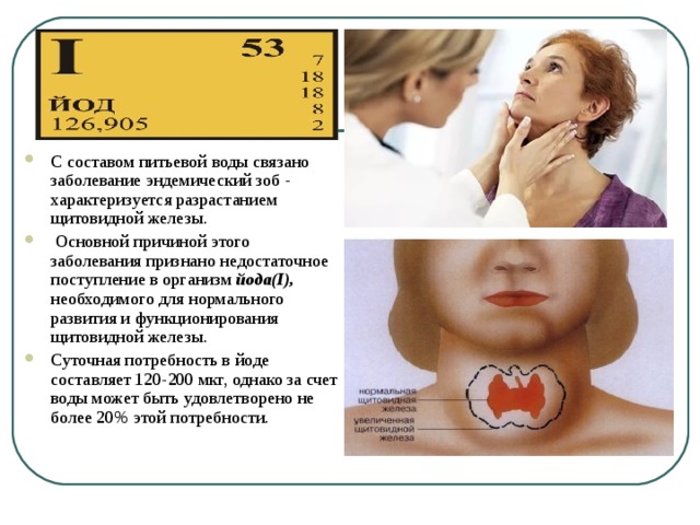 Йод питьевой. Пониженное содержание йода в питьевой воде и пище приводит. Пониженное содержание йода в питьевой воде. Пониженное содержание йода в воде приводит. Пониженное содержание йода в питьевой воде приводит.