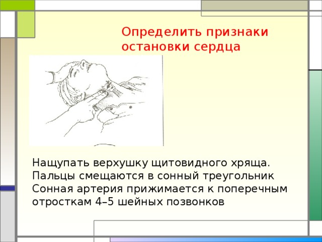 Признаком остановки сердца не является. Признаки остановки сердца. Определение признаков остановки сердца. Основные симптомы остановки сердца. Определение признаки остановки сердечной деятельности.