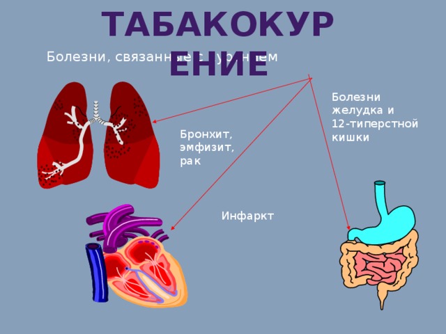 табакокурение Болезни, связанные с курением Болезни желудка и 12-типерстной кишки Бронхит, эмфизит, рак Инфаркт 