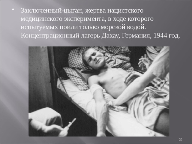 Заключенный-цыган, жертва нацистского медицинского эксперимента, в ходе которого испытуемых поили только морской водой. Концентрационный лагерь Дахау, Германия, 1944 год.