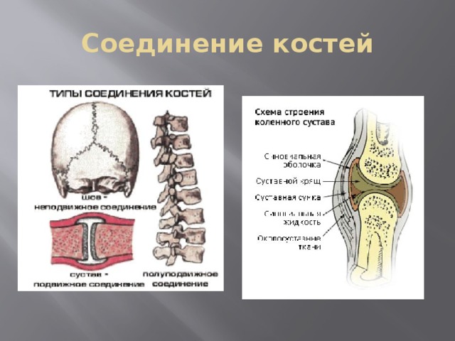 Соединение костей 6. Типы соединения костей. Схема соединения костей. Типы соединения костей схема. Строение состав и соединение костей.