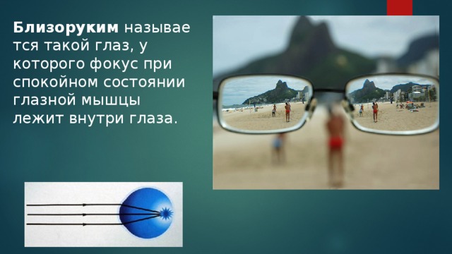 Зрение и их примеры