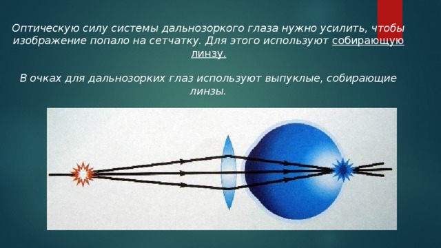 Дальнозорким людям необходимо использовать очки так как у них изображение фокусируется за сетчаткой