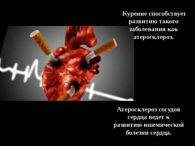  Курение способствует развитию такого заболевания как атеросклероз. Атеросклероз сосудов сердца ведет к развитию ишемической болезни сердца. 