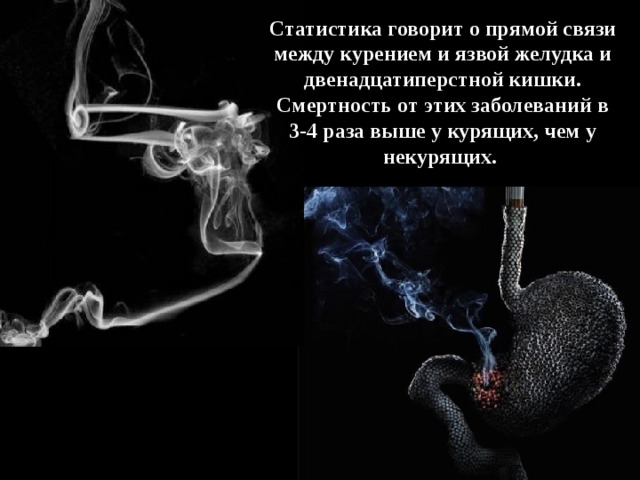 Статистика говорит о прямой связи между курением и язвой желудка и двенадцатиперстной кишки. Смертность от этих заболеваний в 3-4 раза выше у курящих, чем у некурящих.  