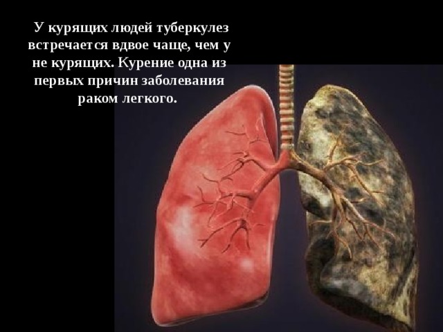  У курящих людей туберкулез встречается вдвое чаще, чем у не курящих. Курение одна из первых причин заболевания раком легкого.  
