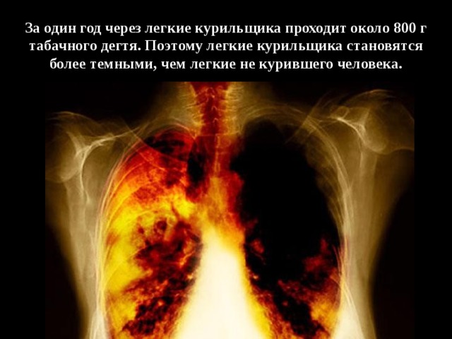 За один год через легкие курильщика проходит около 800 г табачного дегтя. Поэтому легкие курильщика становятся более темными, чем легкие не курившего человека. 
