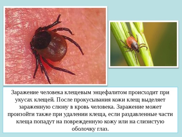 Заражение человека клещевым энцефалитом происходит при укусах клещей. После прокусывания кожи клещ выделяет зараженную слюну в кровь человека. Заражение может произойти также при удалении клеща, если раздавленные части клеща попадут на поврежденную кожу или на слизистую оболочку глаз. 