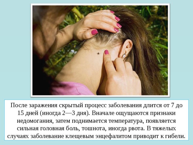 После заражения скрытый процесс заболевания длится от 7 до 15 дней (иногда 2—3 дня). Вначале ощущаются признаки недомогания, затем поднимается температура, появляется сильная головная боль, тошнота, иногда рвота. В тяжелых случаях заболевание клещевым энцефалитом приводит к гибели. 