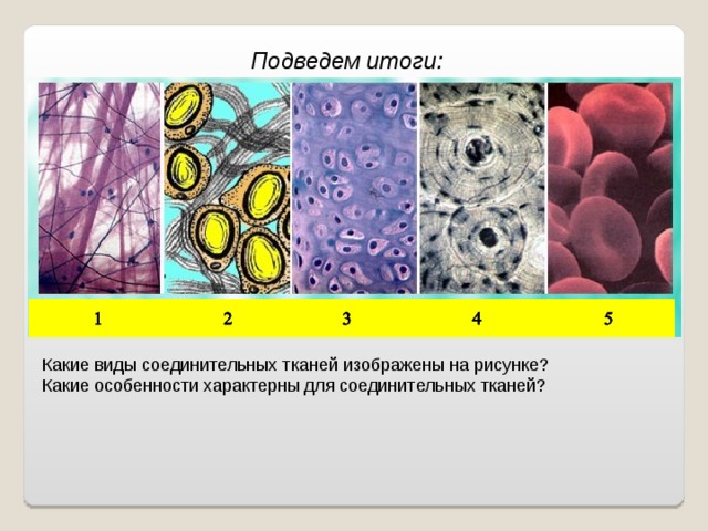 Подведем итоги: Какие виды соединительных тканей изображены на рисунке? Какие особенности характерны для соединительных тканей?  