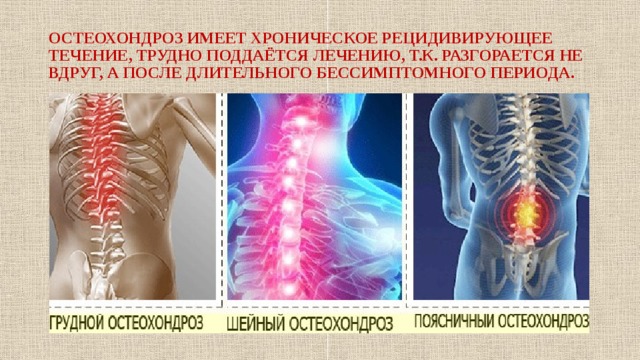 Грудной остеохондроз тяжело. Остеохондроз позвоночника это хроническое. Профилактика грудного остеохондроза. Памятка по остеохондрозу. Шейный остеохондроз буклет.