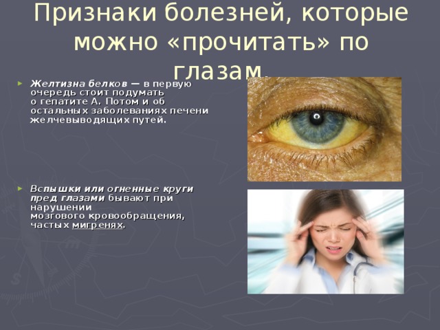 Как узнать какой болезнь. Выявление болезней по глазам. Болезни определяющие по глазам. Болезни по глазам человека.