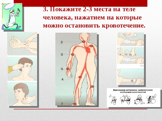 3. Покажите 2-3 места на теле человека, нажатием на которые можно остановить кровотечение.   