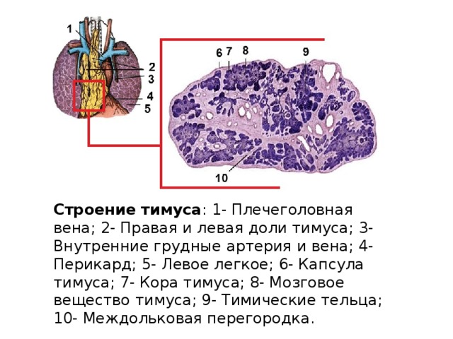 Строение тимуса : 1- Плечеголовная вена; 2- Правая и левая доли тимуса; 3- Внутренние грудные артерия и вена; 4- Перикард; 5- Левое легкое; 6- Капсула тимуса; 7- Кора тимуса; 8- Мозговое вещество тимуса; 9- Тимические тельца; 10- Междольковая перегородка.   
