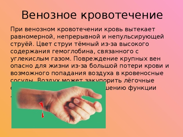 Из приведенных примеров выберите характеризующие венозные кровотечения