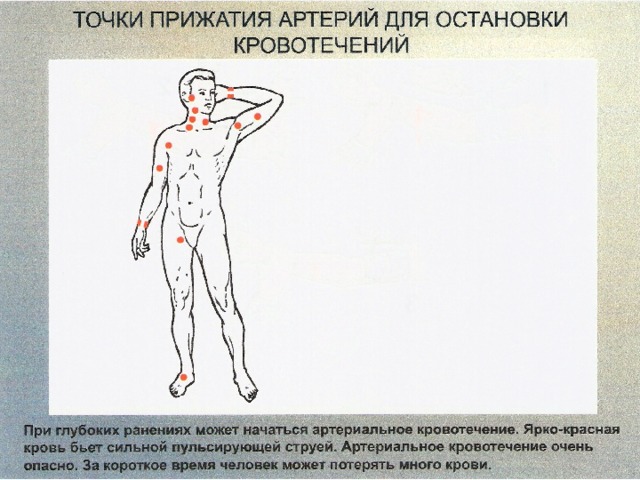 Покажите на рисунке из учебного пособия точки прижатия важнейших артерий сонной