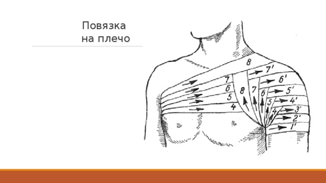 Как замотать плечо эластичным бинтом самому схема