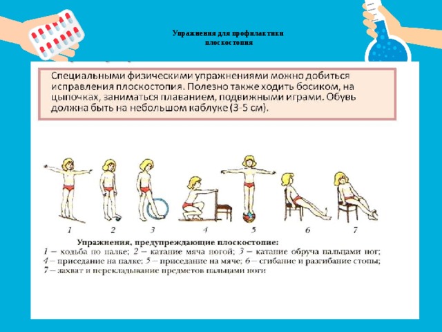 Лфк при плоскостопии презентация